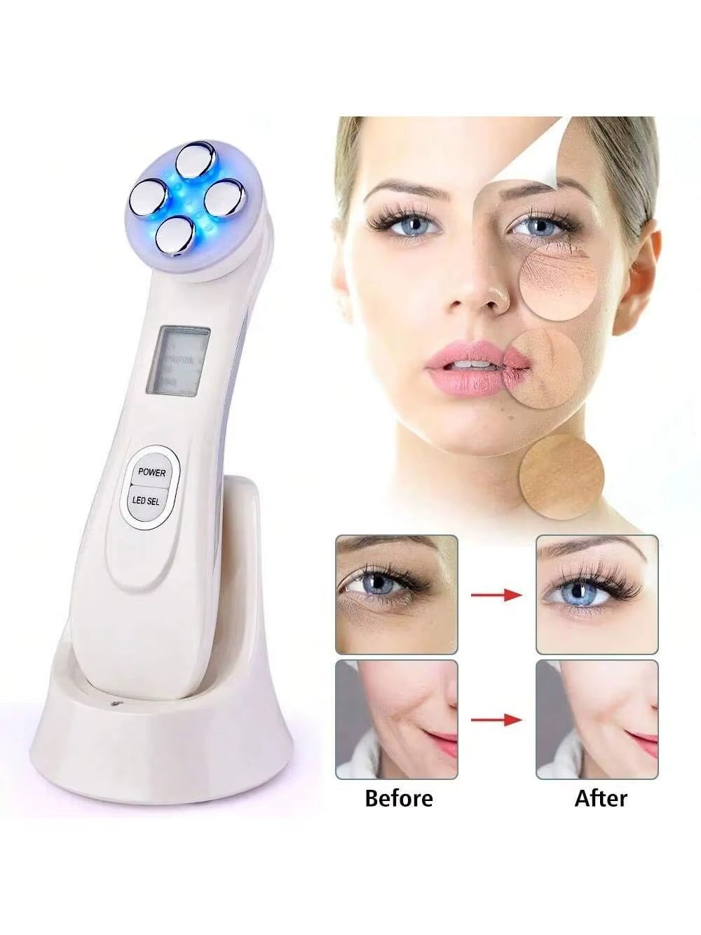 Professional Facial Cleansing Device – Peeling, Blackhead and Dead Skin Removal, Refreshes and Revitalizes the Skin